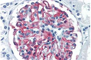 Human Kidney (formalin-fixed, paraffin-embedded) stained with CR1 antibody ABIN337278 at 10 ug/ml followed by biotinylated anti-mouse IgG secondary antibody ABIN481714, alkaline phosphatase-streptavidin and chromogen. (CD35 Antikörper)