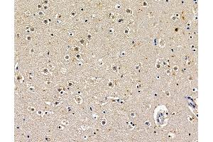 ABIN7097016 and ABIN7101083 at 1/100 staining mouse brain tissue by IHC-P.
