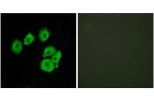 Immunofluorescence analysis of HuvEc cells, using CLTR1 Antibody. (CysLTR1 Antikörper  (AA 131-180))