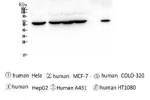 Western blot analysis of TCP1 alpha using anti-TCP1 alpha antibody .