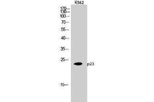 Western Blotting (WB) image for anti-Cyclin-Dependent Kinase 5, Regulatory Subunit 1 (p35) (CDK5R1) (Tyr579) antibody (ABIN3180222) (CDK5R1 Antikörper  (Tyr579))