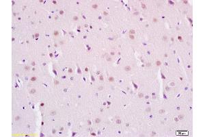Formalin-fixed and paraffin embedded rat brain labeled with Anti-Phospho-SIRT1(Ser47) Polyclonal Antibody, Unconjugated (ABIN745658) at 1:200 followed by conjugation to the secondary antibody and DAB staining