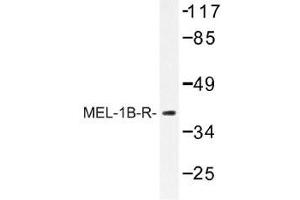 Image no. 1 for anti-Melatonin Receptor 1B (MTNR1B) antibody (ABIN317757) (Melatonin Receptor 1B Antikörper)