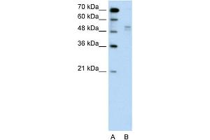 WB Suggested Anti-WWP2 Antibody Titration:  0. (WWP2 Antikörper  (Middle Region))