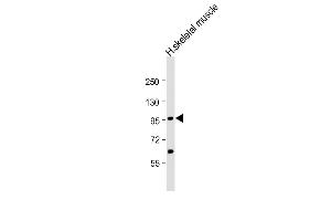 Anti-YY1 Antibody (Center)at 1:2000 dilution + human skeletal muscle lysates Lysates/proteins at 20 μg per lane.