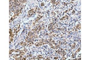 IHC analysis of Neurofibromin/NF1 using anti-Neurofibromin/NF1 antibody (ABIN7600196). (Neurofibromin 1 Antikörper  (AA 160-270))