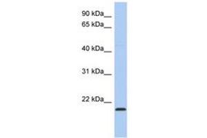 Image no. 1 for anti-RWD Domain Containing 4 (RWDD4) (C-Term) antibody (ABIN6743711) (RWDD4A Antikörper  (C-Term))