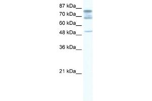 WB Suggested Anti-DDX46 Antibody Titration:  1. (DDX46 Antikörper  (C-Term))