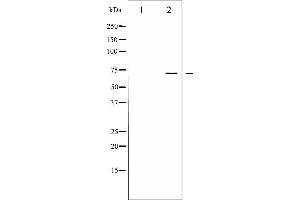 Western blot analysis of LIMK1/2 phosphorylation expression in HeLa whole cell lysates,The lane on the left is treated with the antigen-specific peptide. (LIMK-1/2 (pThr505), (pThr508) Antikörper)