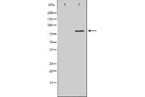 Western blot analysis of Hela whole cell lysates, using DCLRE1C Antibody. (DCLRE1C Antikörper  (C-Term))