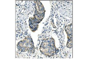IHC analysis of ANGPT2 using anti-ANGPT2 antibody (ABIN7601450).