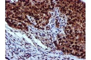 Image no. 5 for anti-EPM2A (Laforin) Interacting Protein 1 (EPM2AIP1) antibody (ABIN1498045) (EPM2AIP1 Antikörper)