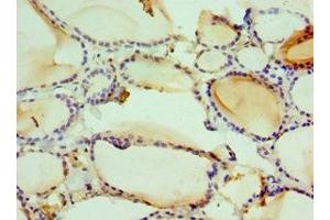 Immunohistochemistry of paraffin-embedded human thyroid tissue using ABIN7161681 at dilution of 1:100