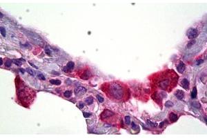 Anti-HSD11B1 antibody IHC staining of human lung, macrophages. (HSD11B1 Antikörper)
