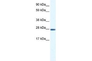 WB Suggested Anti-CLIC1 Antibody Titration:  0. (CLIC1 Antikörper  (C-Term))
