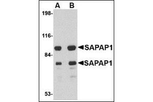 Western blot analysis of SAPAP1 in rat brain tissue lysate with this product at (A) 0. (DLGAP1 Antikörper  (Center))