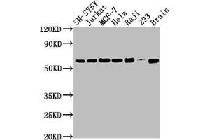 Western Blot Positive WB detected in: SH-SY5Y whole cell lysate, Jurkat whole cell lysate, MCF-7 whole cell lysate, Hela whole cell lysate, Raji whole cell lysate, 293 whole cell lysate, Mouse brain tissue All lanes: PKM antibody at 1:2000 Secondary Goat polyclonal to rabbit IgG at 1/50000 dilution Predicted band size: 58, 59, 57 kDa Observed band size: 58 kDa (Rekombinanter PKM Antikörper)