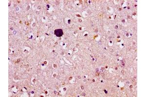 IHC image of ABIN7144809 diluted at 1:100 and staining in paraffin-embedded human brain tissue performed on a Leica BondTM system. (ATL1 Antikörper  (AA 220-350))