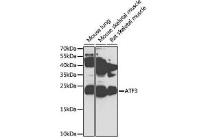 Western blot analysis of extracts of various cell lines, using  antibody (ABIN3023657, ABIN3023658, ABIN3023659, ABIN1678765 and ABIN6218982) at 1:1000 dilution.