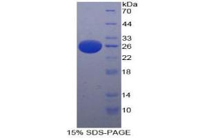 SDS-PAGE analysis of Human PAFAH1B3 Protein.