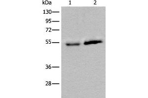 Western blot analysis of Human fetal intestines tissue and Human breast cancer tissue lysates using CCDC85C Polyclonal Antibody at dilution of 1:400 (CCDC85C Antikörper)