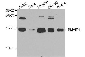 Western blot analysis of extracts of various cell lines, using PMAIP1 antibody (ABIN6003533) at 1/1000 dilution. (NOXA Antikörper)