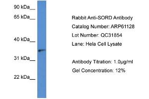 Western Blotting (WB) image for anti-Sorbitol Dehydrogenase (SORD) (N-Term) antibody (ABIN2788686) (SORD Antikörper  (N-Term))