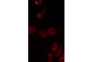 Immunofluorescence (fixed cells) (IF/ICC) image for anti-Chloride Channel, Voltage-Sensitive 7 (CLCN7) (N-Term) antibody (ABIN6259518)