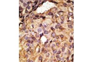 Image no. 3 for anti-Toll-Like Receptor 6 (TLR6) (C-Term) antibody (ABIN357055) (TLR6 Antikörper  (C-Term))