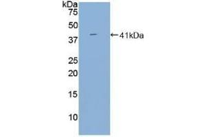Detection of Recombinant BAFFR, Human using Polyclonal Antibody to B-Cell Activation Factor Receptor (BAFFR) (BAFF Antikörper  (AA 96-184))