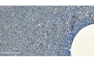 IHC analysis of CD20/MS4A1 using anti-CD20/MS4A1 antibody (ABIN7599233). (CD20 Antikörper  (AA 1-297))