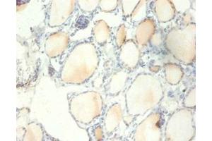 Immunohistochemistry of paraffin-embedded human thyroid tissue using ABIN7142488 at dilution of 1:100 (RPS13 Antikörper  (AA 3-151))