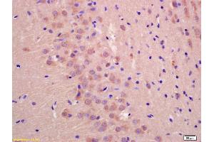 Formalin-fixed and paraffin embedded rat brain labeled with Anti-UBXD2 Polyclonal Antibody, Unconjugated (ABIN1386176) at 1:200 followed by conjugation to the secondary antibody and DAB staining (UBXD2 Antikörper  (AA 201-300))