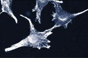Immunofluorescence staining of CPAE cells (bovine pulmonary artery endothelial cells, ATCC CCL-209).