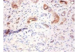 Immunohistochemistry of paraffin-embedded human kidney tissue using ABIN7143786 at dilution of 1:100 (Fetuin A Antikörper  (AA 20-296))