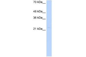 WB Suggested Anti-CDX4 Antibody Titration: 0. (CDX4 Antikörper  (Middle Region))