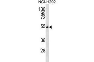 Western Blotting (WB) image for anti-serine/arginine-Rich Splicing Factor 11 (SRSF11) antibody (ABIN2997053) (SRSF11 Antikörper)