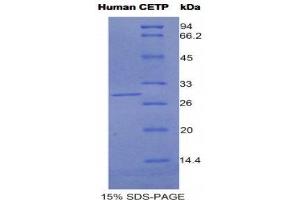 SDS-PAGE (SDS) image for Cholesteryl Ester Transfer Protein (CETP) (AA 81-311) protein (His tag) (ABIN1525385) (CETP Protein (AA 81-311) (His tag))