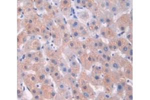 Immunohistochemistry (Paraffin-embedded Sections) (IHC (p)) image for anti-Mucin 2, Oligomeric Mucus/gel-Forming (MUC2) (AA 5075-5179) antibody (ABIN2915723)