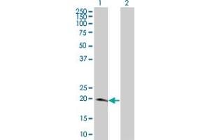 Lane 1: NME6 transfected lysate ( 22 KDa) Lane 2: Non-transfected lysate.