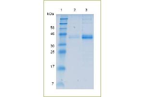 SDS-PAGE analysis of recombinant IL12 p40.
