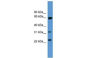 WB Suggested Anti-CLTA Antibody Titration: 0. (CLTA Antikörper  (C-Term))