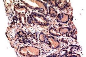 Immunohistochemistry of paraffin-embedded Human prostate tissue using CASP3 Monoclonal Antibody at dilution of 1:200.