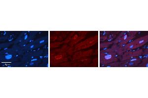Rabbit Anti-ERF Antibody   Formalin Fixed Paraffin Embedded Tissue: Human heart Tissue Observed Staining: Nucleus Primary Antibody Concentration: 1:100 Other Working Concentrations: 1:600 Secondary Antibody: Donkey anti-Rabbit-Cy3 Secondary Antibody Concentration: 1:200 Magnification: 20X Exposure Time: 0.