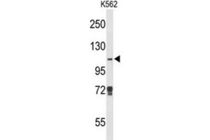 Western Blotting (WB) image for anti-Lysine (K)-Specific Demethylase 4B (KDM4B) antibody (ABIN3004159)