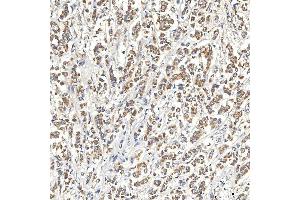 IHC analysis of SNPH using anti-SNPH antibody (ABIN7601724). (Syntaphilin Antikörper  (AA 43-482))