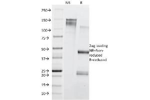 SDS-PAGE Analysis Purified CD71 Mouse Monoclonal Antibody (TFRC/1839). (Transferrin Receptor Antikörper  (AA 94-212))