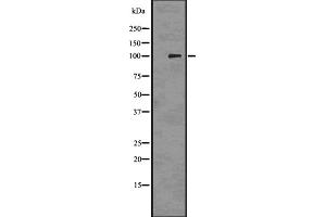 Western blot analysis of PMEL17 / GP100 using 293 whole cell lysates (Melanoma gp100 Antikörper  (C-Term))