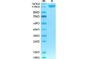 Human DPPIV on Tris-Bis PAGE under reduced condition. (DPP4 Protein (Fc Tag))