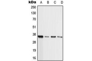 Western blot analysis of MLL4 expression in HL60 (A), A549 (B), NIH3T3 (C), H9C2 (D) whole cell lysates.
